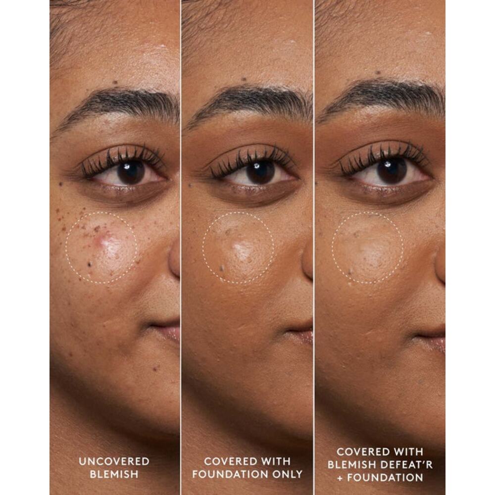 $25 New Fenty Skin Blemish Defeat’r BHA Spot Targeting Gel - Picture 6 of 12
